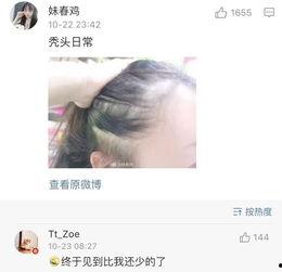 秃崽被爆料视频在线观看,揭秘背后惊人真相  第2张